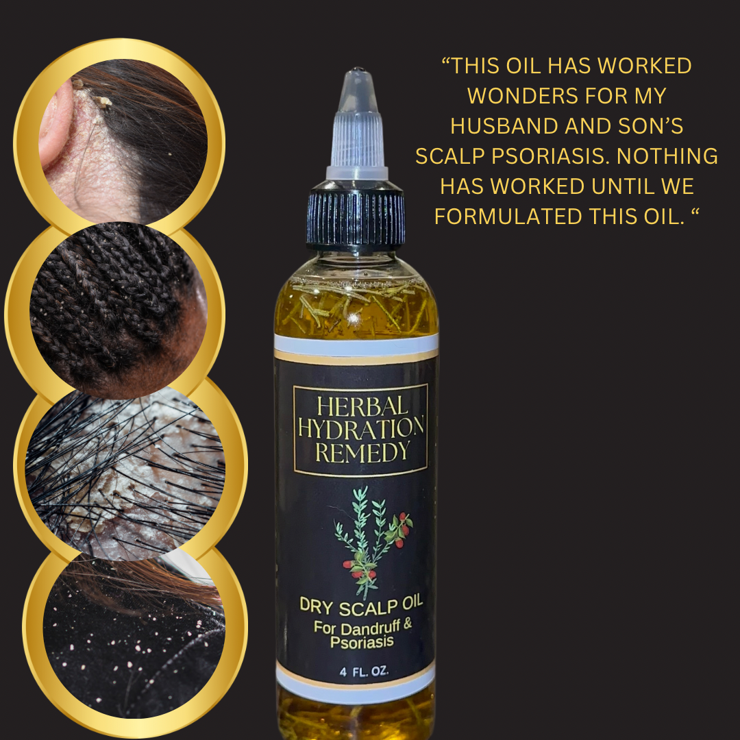 Herbal Hydration Remedy Dry Scalp Oil